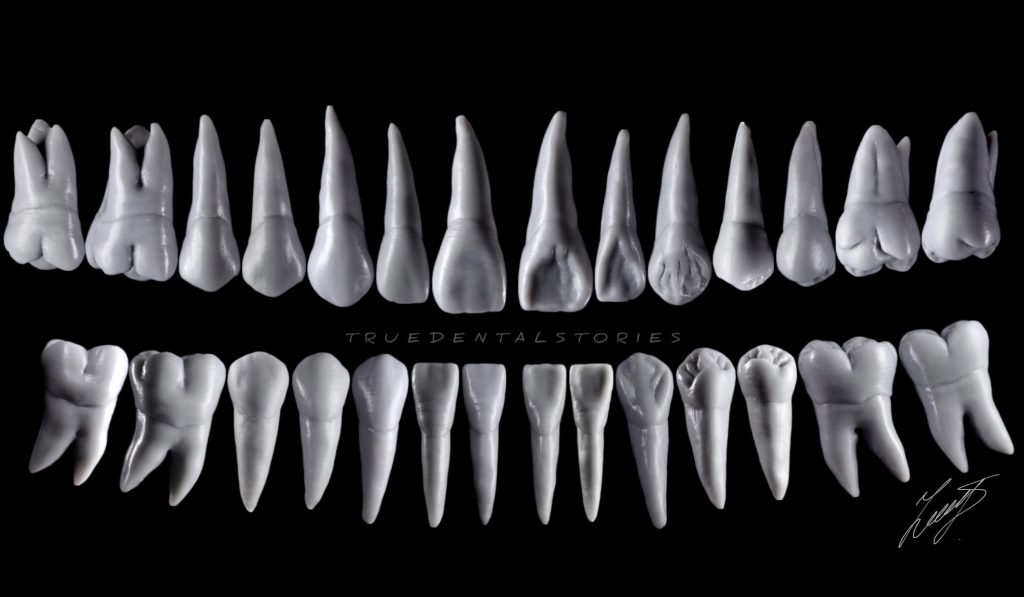 What dental prostheses types should you consider